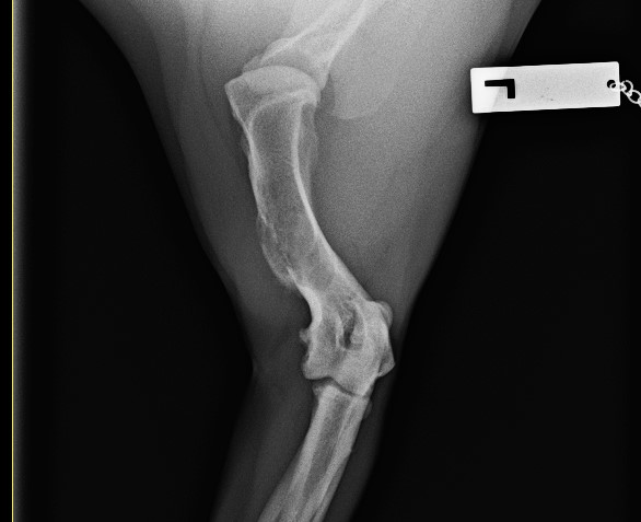 xray image of Raff's left leg showing osteosarcoma